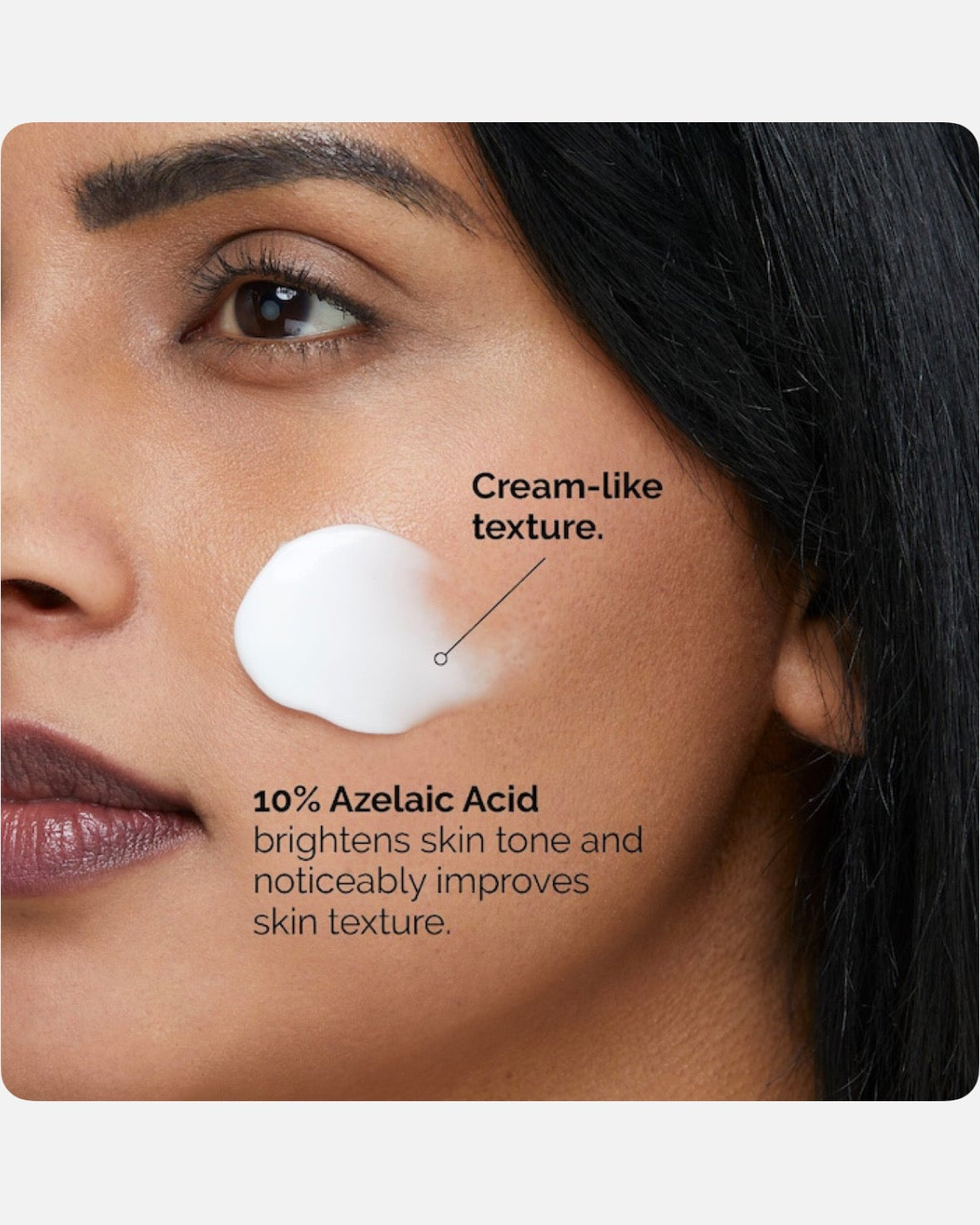 The Ordinary Azelaic Acid Suspension 10% Cream for Redness and Blemish-Prone Skin